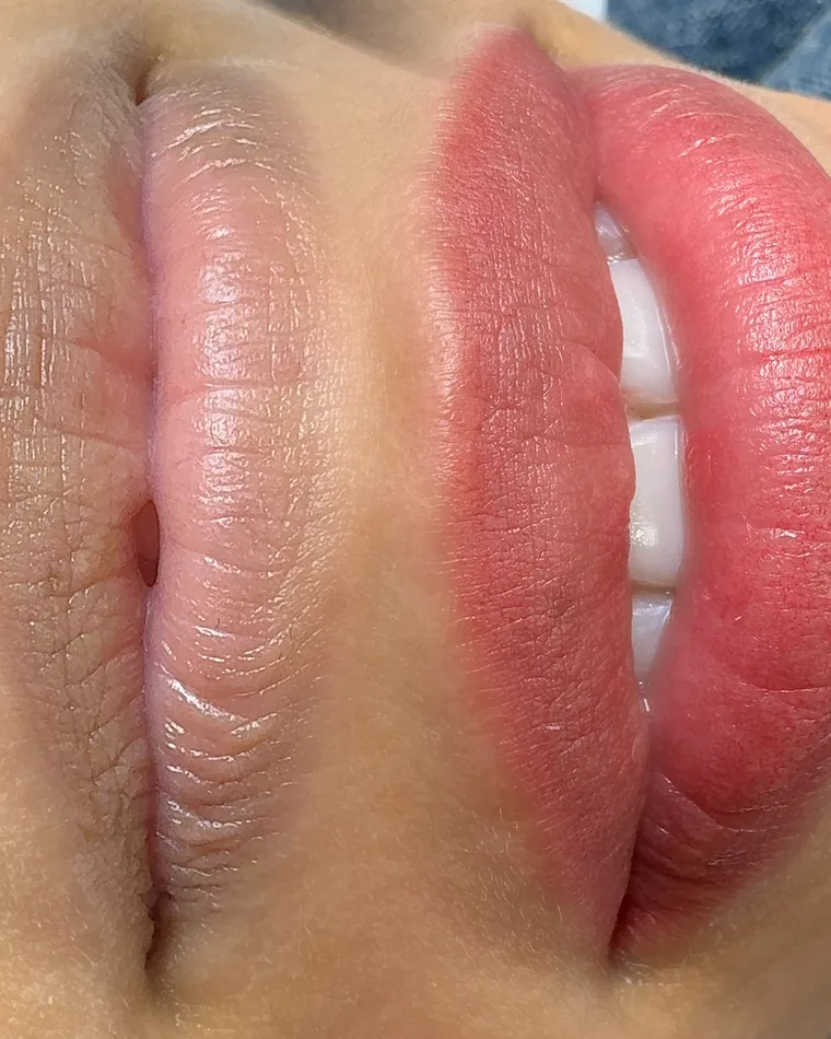 Dark Lip Neutralization result by Adriana's Permanent Makeup