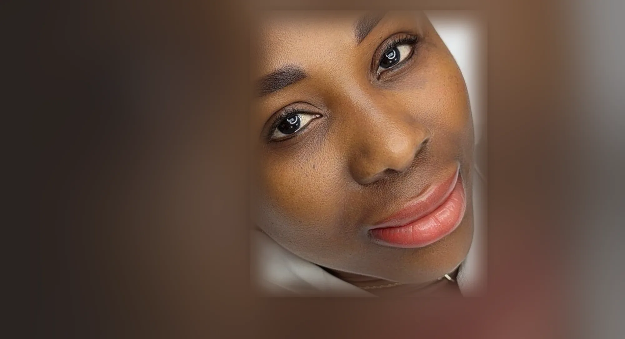Dark Lip Neutralization result on a client, with an even, natural lip tone