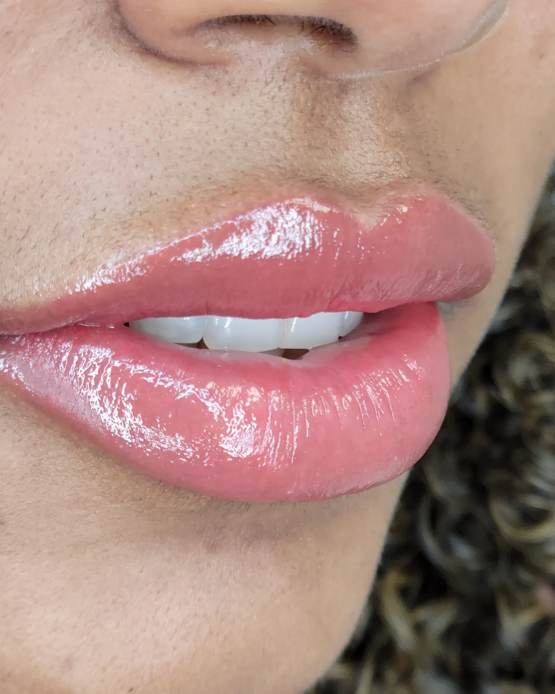 After neutralization: the grey cast is gone and the tone reads even. Lips after dark lip neutralization, showing an even warm pink tone with no grey cast