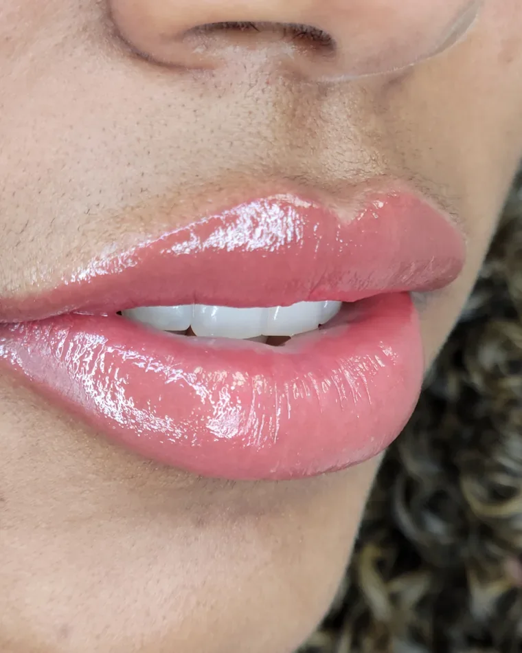 Dark Lip Neutralization result by Adriana's Permanent Makeup