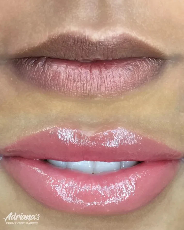 Dark Lip Neutralization